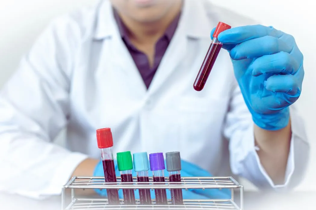 Лікар-нарколог готує ін'єкцію для кодування Торпедо, Одеса