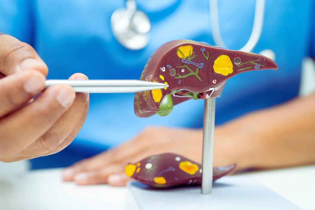 Схематичне зображення здорової та ураженої алкоголем печінки